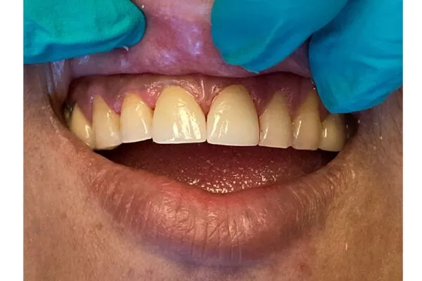 afterfutch 600x400 1 - Futch Dental