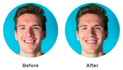 before after 1 - Futch Dental