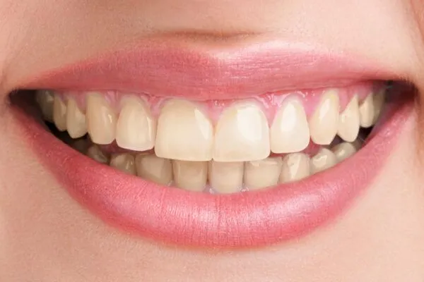 before after sample 600x400 1 - Futch Dental