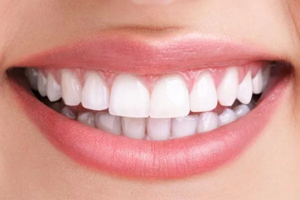 before after sample2 600x400 1 - Futch Dental