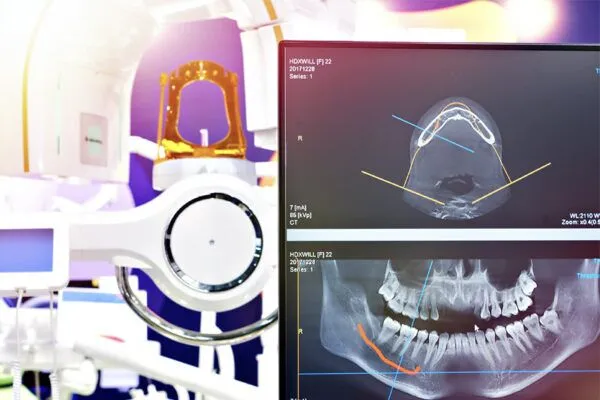 digital xrays 1 600x400 1 - Futch Dental