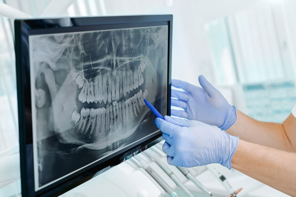 x-ray